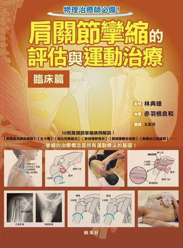 肩関節拘縮の評価と運動療法 臨床編