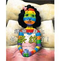 A Bad Case of Stripes